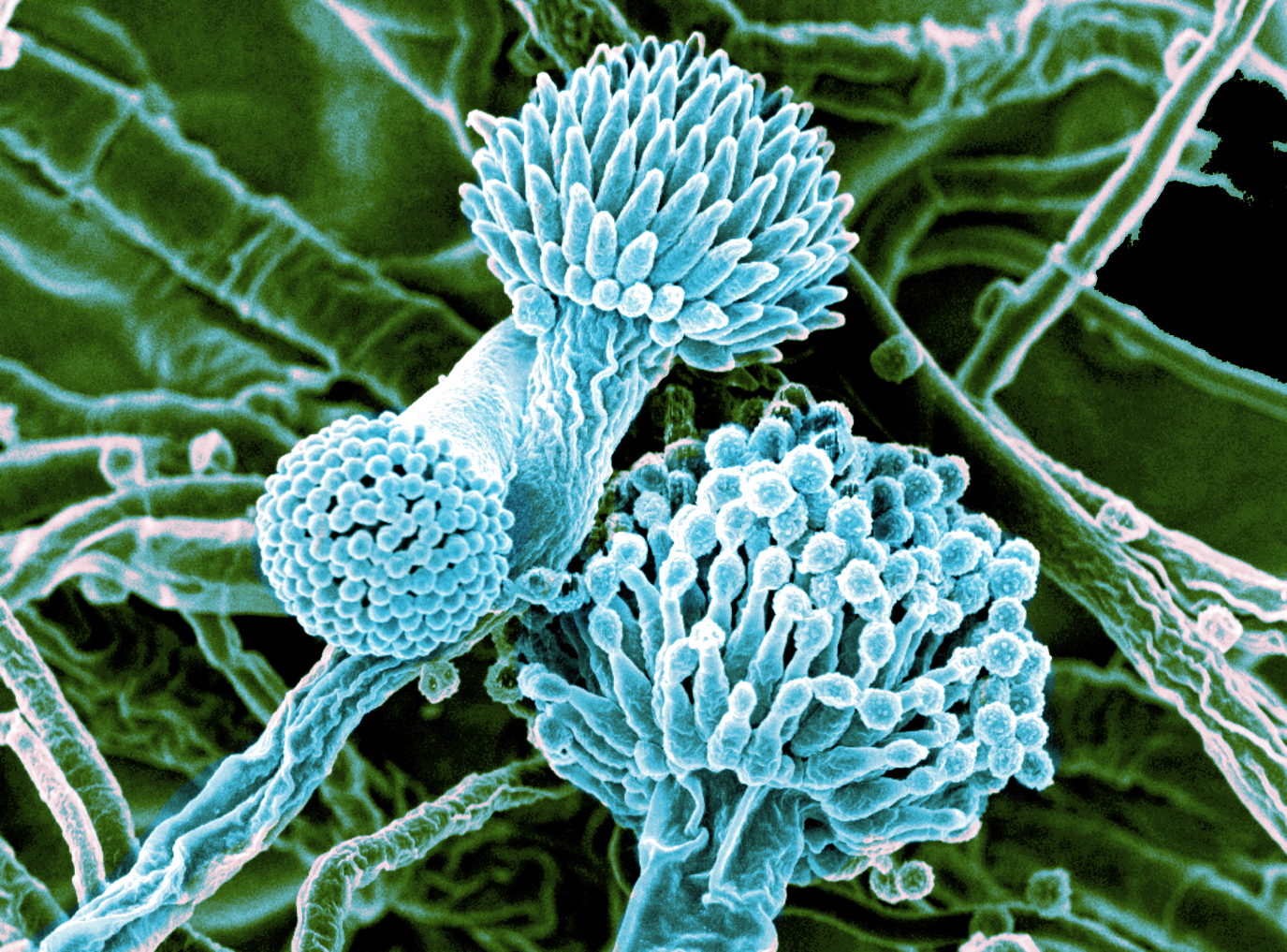 aspergillus-in-hospital-ductwork-creates-a-danger